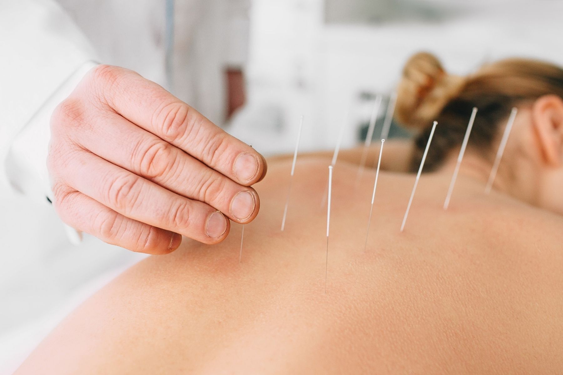 acupuntura reduce los dolores